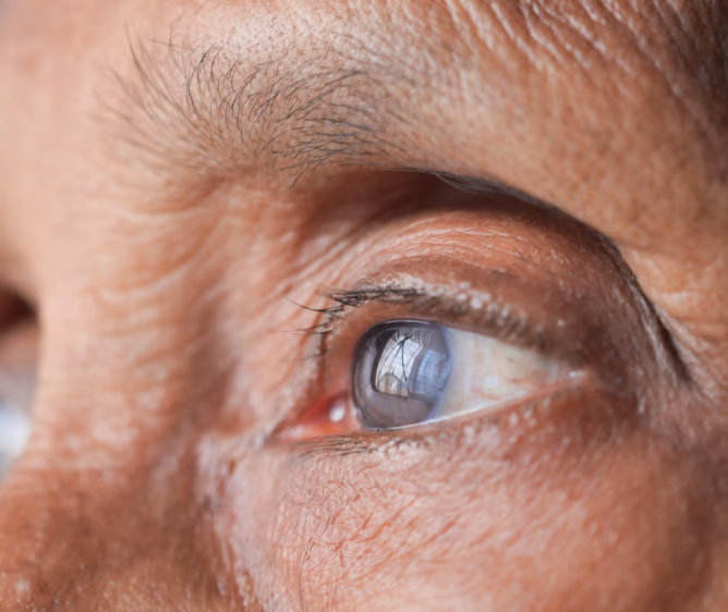 vis-img__women-eye-cu-001 Visionaries Eye Specialists | Dr Nick Toalster | Brisbane